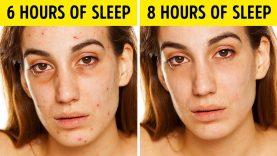 20 EASY SLEEPING HACKS TO BEAT INSOMNIA AND IMPROVE YOUR HEALTH